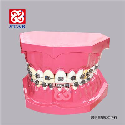 10倍標(biāo)準正畸模型M7035